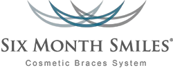 Six Month Smiles Braces
